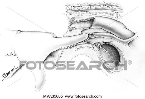 MVA35005.jpg