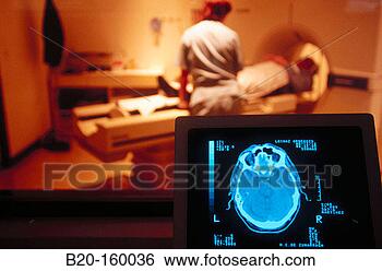 Stock Photo - cat scan. fotosearch 
- search stock 
photos, pictures, 
images, and photo 
clipart