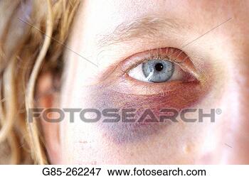 Picture - abusing, blue 
eyed, anonymity, 
adults, abuse. 
fotosearch - search 
stock photos, 
pictures, images, 
and photo clipart