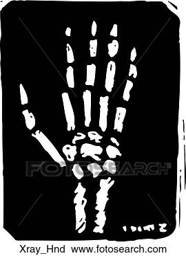 Clipart - x-ray hand. fotosearch 
- search clipart, 
illustration, 
drawings and vector 
eps graphics images
