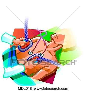 Stock Illustration - using defibrillator 
paddles. fotosearch 
- search clipart, 
illustration, 
drawings and vector 
eps graphics images