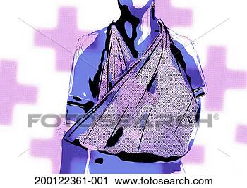 Clipart - person with arm 
in sling, mid-section 
(digital). fotosearch 
- search clipart, 
illustration, 
drawings and vector 
eps graphics images