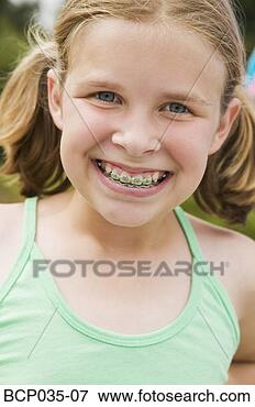 Picture - smiling girl wearing 
orthodontic braces. 
fotosearch - search 
stock photos, 
pictures, images, 
and photo clipart