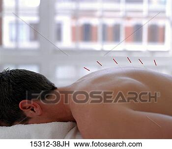 Stock Photo - man with acupuncture 
needles in his 
back. fotosearch 
- search stock 
photos, pictures, 
images, and photo 
clipart