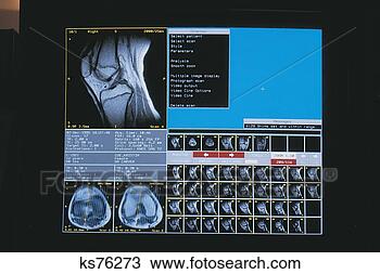 Banco de Imagem - médico,  tecnologia. 
fotosearch - busca 
de fotos, imagens 
e clipart