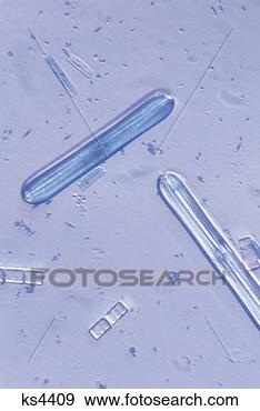Stock Photograph - mixed diatoms, 
400x. fotosearch 
- search stock 
photos, pictures, 
images, and photo 
clipart