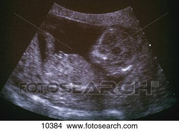 Stock Photo - ultrasound image 
of fetus in womb. 
fotosearch - search 
stock photos, 
pictures, images, 
and photo clipart