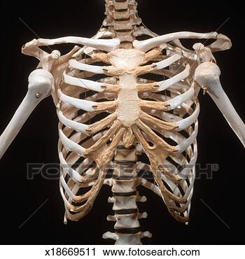10 examples of skeletal abnormalities