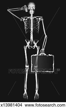 Stock Illustration - x-ray image of 
a person holding 
a briefcase and 
a mobile phone 
to the. fotosearch 
- search clipart, 
illustration, 
drawings and vector 
eps graphics images
