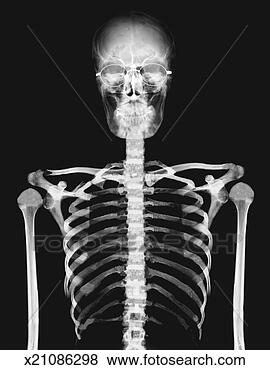 Stock Illustration - x-ray image of 
the torso of a 
person wearing 
spectacles. fotosearch 
- search clipart, 
illustration, 
drawings and vector 
eps graphics images