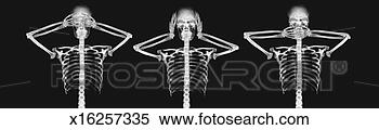 Stock Illustration - x-ray image of 
two people covering 
their eyes and 
ears. fotosearch 
- search clipart, 
illustration, 
drawings and vector 
eps graphics images
