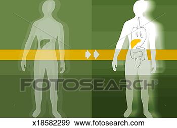 Stock Illustration - liver transplant. 
fotosearch - search 
clipart, illustration, 
drawings and vector 
eps graphics images