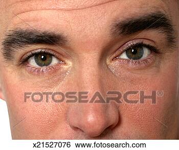 Stock Photo - wrinkled forehead. 
fotosearch - search 
stock photos, 
pictures, images, 
and photo clipart