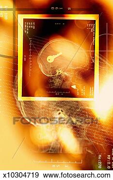 Stock Illustration - composite of skull 
x-ray with key. 
fotosearch - search 
clipart, illustration, 
drawings and vector 
eps graphics images