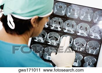 Stock Photography - rear view of a 
surgeon looking 
at an x-ray. fotosearch 
- search stock 
photos, pictures, 
images, and photo 
clipart