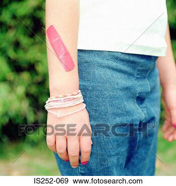 Stock Photograph - arm with plaster. 
fotosearch - search 
stock photos, 
pictures, images, 
and photo clipart