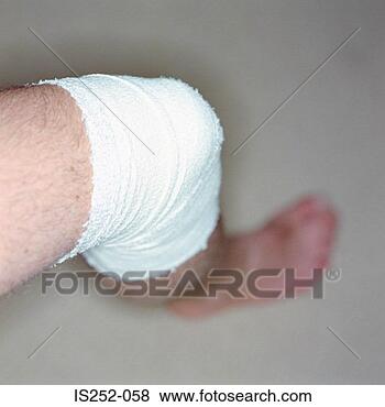 Stock Photo - injured leg. fotosearch 
- search stock 
photos, pictures, 
images, and photo 
clipart