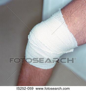 Stock Photograph - injured leg. fotosearch 
- search stock 
photos, pictures, 
images, and photo 
clipart