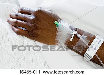 Stock Photography - arm of patient 
with drip. fotosearch 
- search stock 
photos, pictures, 
images, and photo 
clipart