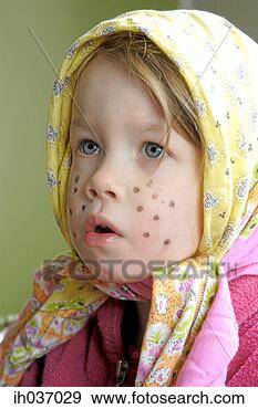 Stock Photograph - girl with spots 
on her face. fotosearch 
- search stock 
photos, pictures, 
images, and photo 
clipart
