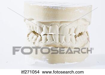 Stock Photo - tooth cast. fotosearch 
- search stock 
photos, pictures, 
images, and photo 
clipart