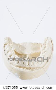 Stock Image - tooth cast. fotosearch 
- search stock 
photos, pictures, 
images, and photo 
clipart