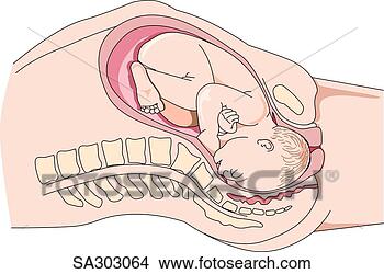 Stock Illustration - view of a full 
term fetus during 
delivery; head 
of fetus has entered. 
fotosearch - search 
clipart, illustration, 
drawings and vector 
eps graphics images