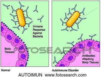 Hazır İlüstrasyonlar - autoimmunity. 
fotosearch - klipart 
İlüstrasyon, çizimler 
ve görüntüler 
ara