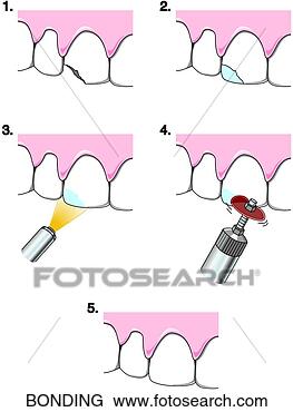 Clip Art - ligar, ligar. 
fotosearch - busca 
de ilustrações 
clipeart e desenhos
