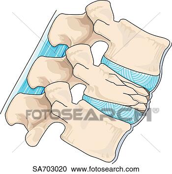 COMPRESION COLUMNA VERTEBRAL compresion columna vertebral: