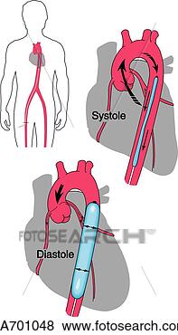 Stock Illustration - outline of heart 
showing action 
of intra-aortic 
balloon pump during. 
fotosearch - search 
clipart, illustration, 
drawings and vector 
eps graphics images