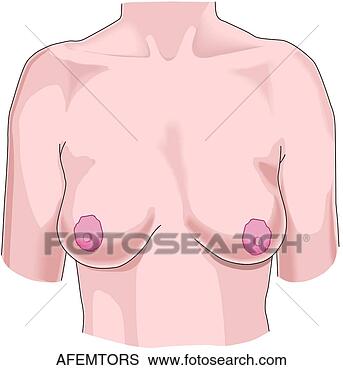 Arquivos de Ilustração - formiga,  femininas, 
 torso. fotosearch 
- busca de ilustrações 
clipeart e desenhos