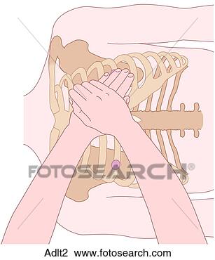 Clip Art - cpr,  posicionar, 
 adulto. fotosearch 
- busca de ilustrações 
clipeart e desenhos