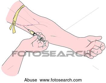 Clipart - droga,  abuse-injection. 
fotosearch - busca 
de ilustrações 
clipeart e desenhos