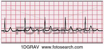Hazır İlüstrasyonlar - 1st, degree, av, 
block. fotosearch 
- klipart İlüstrasyon, 
çizimler ve görüntüler 
ara