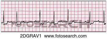 Klipart - 2nd, degree, av, 
block, type, 1. 
fotosearch - klipart 
İlüstrasyon, çizimler 
ve görüntüler 
ara