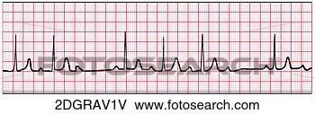 Hazır İlüstrasyonlar - 2nd, degree, av, 
block, type, 1. 
fotosearch - klipart 
İlüstrasyon, çizimler 
ve görüntüler 
ara