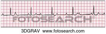 Hazır İlüstrasyonlar - 3rd, degree, av, 
block. fotosearch 
- klipart İlüstrasyon, 
çizimler ve görüntüler 
ara