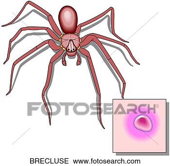 Klipart - brown, recluse, 
spider. fotosearch 
- klipart İlüstrasyon, 
çizimler ve görüntüler 
ara
