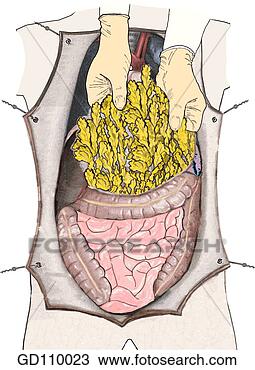 Drawing - reflect the greater 
omentum superiorly 
to expose the 
small and large. 
fotosearch - search 
clipart, illustration, 
drawings and vector 
eps graphics images