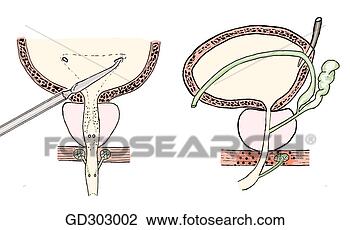 Clip Art - bladder,  prostate, 
 deep perineal 
space,  and proximal 
portion of. fotosearch 
- search clipart, 
illustration, 
drawings and vector 
eps graphics images