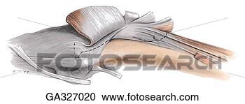 Arquivos de Ilustração - medial,  aspecto, 
 joelho,  c,  
articularis,  
genu,  músculo, 
 este. fotosearch 
- busca de ilustrações 
clipeart e desenhos