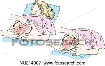 Stock Illustration - a health care 
worker performing 
external cephalic 
version shown 
in. fotosearch 
- search clipart, 
illustration, 
drawings and vector 
eps graphics images