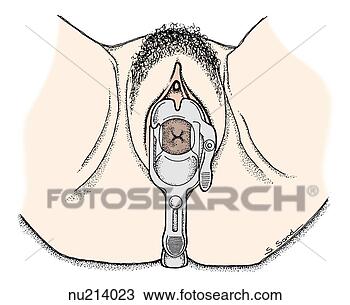 手绘图 - 尾部, 察看, 在中, <em>女性</em>, 外部, <em>生殖</em>器, 在