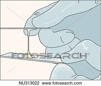 人, 测试, Spinnbarkeit, (stretchability), 子宫颈, 粘