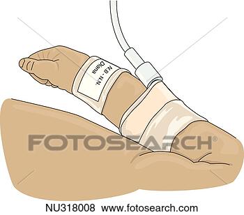 Arquivos de Ilustrações - braço,   criança, 
  mostrado,   
desgastar,   nome, 
  tag,   pulso. 
fotosearch - busca 
de ilustrações 
clipeart e desenhos