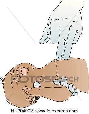 illustration of cardiac
