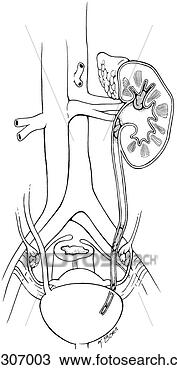 Drawing - simple illustration 
of urinary system 
 kidney and ureter 
are shown in. 
fotosearch - search 
clipart, illustration, 
drawings and vector 
eps graphics images