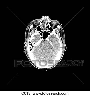 Desenho - cabeça,  pescoço. 
fotosearch - busca 
de ilustrações 
clipeart e desenhos