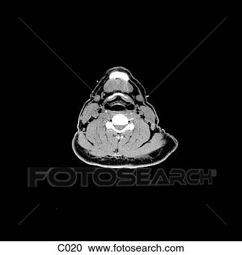 Arquivos de Ilustração - cabeça,  pescoço. 
fotosearch - busca 
de ilustrações 
clipeart e desenhos